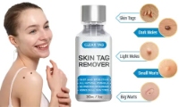 Clear Tag Skin Tag Remover Reviews