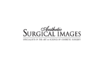 Aesthetic Surgical Images