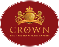 Local Business Crown Hair Transplant Experts | Hair Transplant Clinic In Delhi | FUT & FUE Hair Transplant | Hair Transplant In Delhi, NCR in  