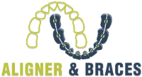 Aligner & Braces - Best Orthodontist & Best Dentist in Delhi | Invisible Aligners & Dental Braces | Clear Aligners in Delhi