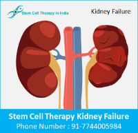 Stem cell therapy for kidney failure in India
