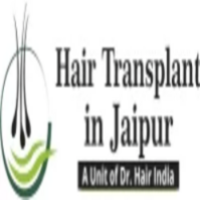Hair Transplant In Jaipur