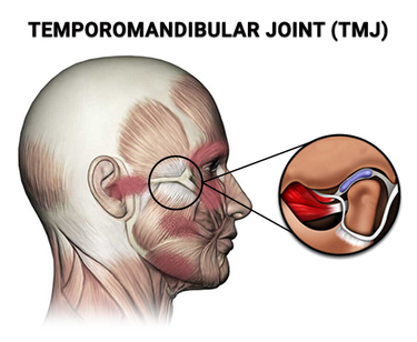 TMJ Treatment Specialist in Stamford, CT