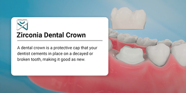 PORCELAIN AND ZIRCONIA DENTAL CROWNS NYC