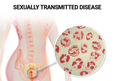 Sexually Transmitted Diseases (STD) Testing in NYC